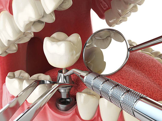 Best Emergency Treatment for Oral Infections in Elmwood Place, OH